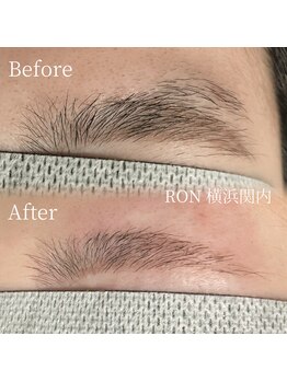 サロンロン 横浜関内(SALON RON)/眉毛脱毛/美容電気脱毛