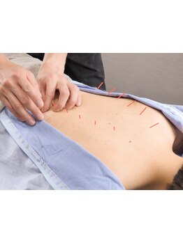 鍼灸施術を受けたい