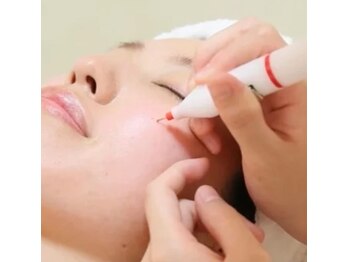 脱毛 痩身ぴゅあら/シミケア