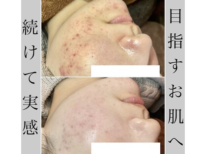 ブラックボックス(BLACK BOX)の写真