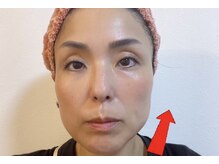 メルシー サロン(Merci Salon)/顔筋トレケアとエラスチン美容？