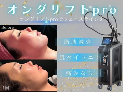 レッド(RED)の写真