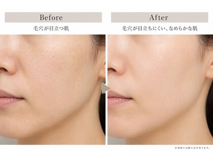 ルアナ(Luana)の写真