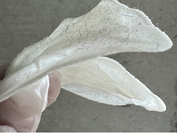 脱毛サロン リグ(LIG)の写真/ヒゲ脱毛実績多数有り！ヒゲ脱毛＆アイブロウワックスで清潔感ある好印象な素顔を目指します☆