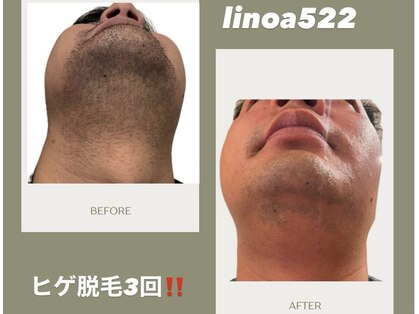 リノア522(Linoa522)の写真