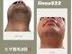 リノア522(Linoa522)の写真