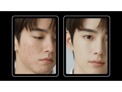 メンズエステ リア(Li'a.)の写真