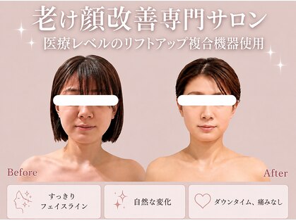 リオ(Rio)の写真