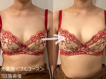 ルーナジェーナ(Luna llena)/バランスの良い綺麗なバストに