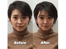 コルミチョン サロン(骨美整 salon)/Before・After 1回施術