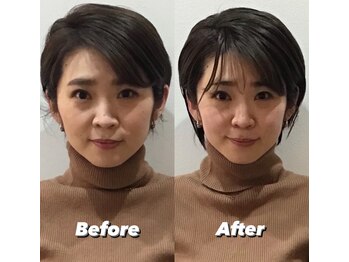 コルミチョン サロン(骨美整 salon)/Before・After 1回施術