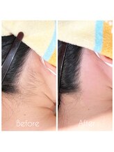 リブメイド(LIB maid)/うなじ脱毛【WAX＋光】