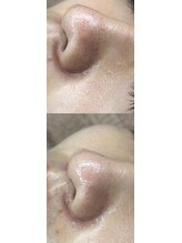 ラ ヴィスタ 川崎店(La Vista)/ララピール