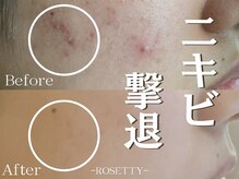 ロゼッティ(ROSETTY)