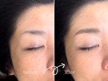 レディゴー(LADY GO)/上がり眉を平行眉へ