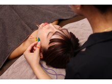 シー バイ カリスタ 吉祥寺店(C by CALISTA)/ お悩みの根本から改善