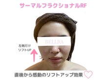 ベルラ(BELLRA)の雰囲気（小顔◆メスを使わない最強小顔施術で自分史上最高の小顔へ★）