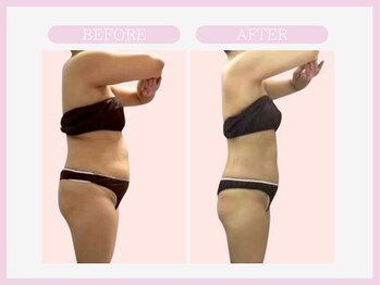 スリムライン 青森店(The Slim Line)/before→after