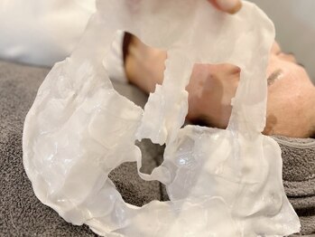 テテ(tete)の写真/【岡山初！フル顔面Wax脱毛】産毛・角質・くすみを取り除きトーンアップした艶肌で化粧ノリもup！