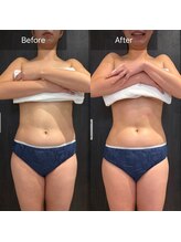 ルネアススパ 南青山(Lune’as Spa)/《WINBACK》くびれ