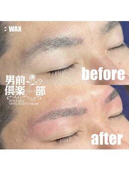 男前倶楽部/脱毛/メンズ脱毛/メンズ専門店