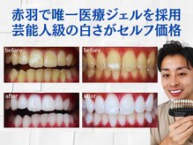 スマイルホワイト 赤羽店