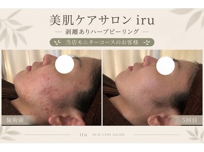 アイル 博多祇園店(iru)の写真