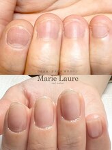 マリーロール 梅田店(Marie Laure)/自爪育成/深爪矯正/ネイルケア