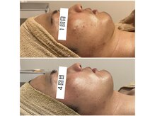 シエル(CieL)/諦めないで！