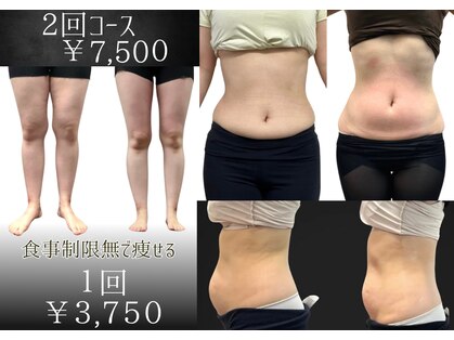 イイチェンジスタイル(iichangestyle)の写真