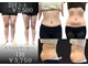 イイチェンジスタイル(iichangestyle)の写真