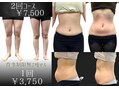 ダイエットサロン iichangestyle 千林大宮