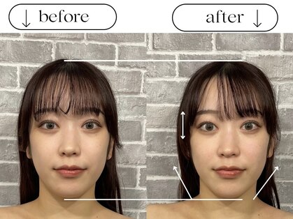ビースタイル(B-style)の写真