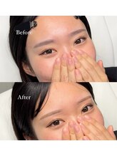 アイブロウドット 姫路(iBROW.)/美眉スタイリング☆befor⇒after