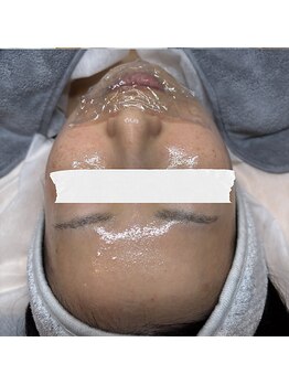 ケーブロッサムビューティーサロン(K Blossom Beauty Salon)/ダクトピール施術中