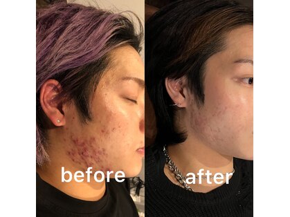 ニクス(nyx)の写真