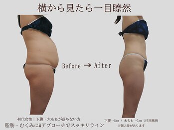 プレリー 自由が丘店/横から見たら一目瞭然