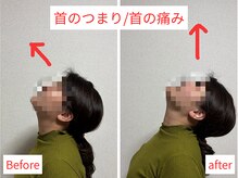 活法術 福岡整体院/首のつまり改善！