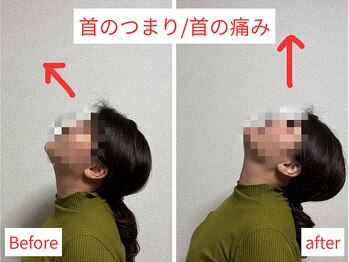 活法術 福岡整体院/首のつまり改善！