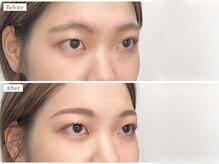 アイコン 小倉店(EYECON)の雰囲気(眉も同時施術でメイク時間を短縮!前髪で隠さない自慢できる眉に)