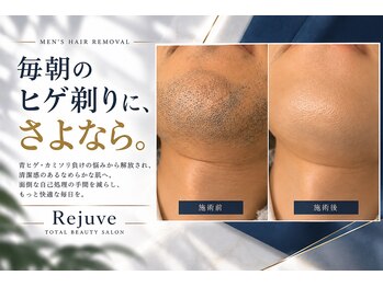 リジュベ(Rejuve)の写真/【脱毛】脱毛デビューにも安心。施術前のカウンセリングと痛み最小限の施術。初めての方も脱毛途中の方も◎