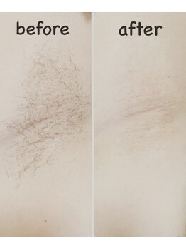 ルアナサロン(LUANA SALON)/両脇ワックス