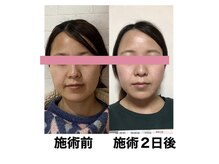 サロンドミジュ(Salon de 美jyu)/小顔・骨格矯正　20代