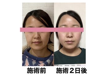 サロンドミジュ(Salon de 美jyu)/小顔・骨格矯正　20代