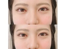 ジェム(gem)/Upforcelift