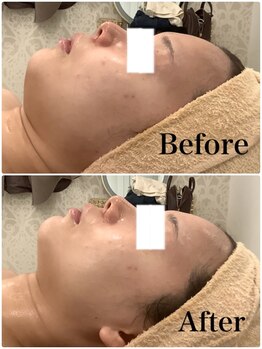 スペチアーレ 夙川/老け顔に効果的の人気メニュー