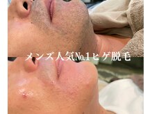 リノ(Lino)の雰囲気（メンズ脱毛メニュー充実。ホームケアも丁寧にサポート）