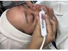 【夏季限定】　毛穴洗浄CICA生炭酸水全顔◆　毛穴角栓取り◎￥3980