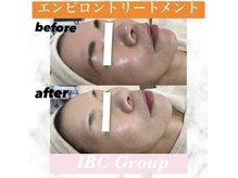 IBC 上大岡店/エンビロンフェイシャル