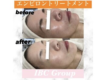 IBC 上大岡店/エンビロンフェイシャル